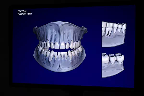 3D scanning and printing