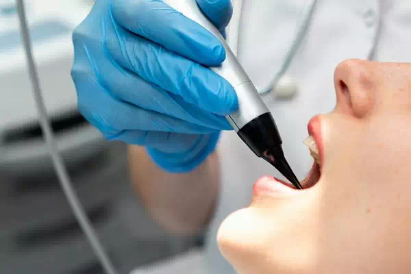 Mouth-Interior Scanner