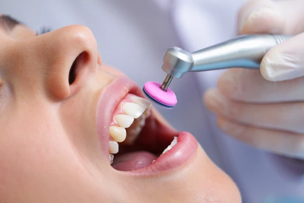 How does dental bonding work