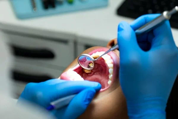 Emergency dentist at Arlington