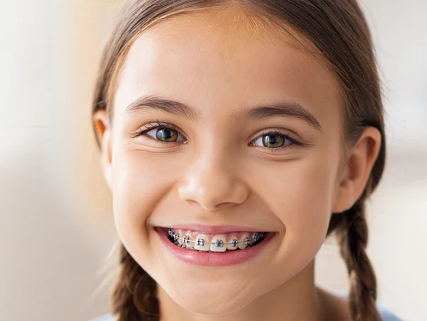 a child with metal braces